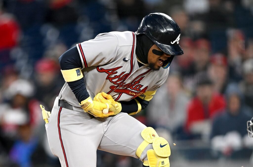 Ronald Acuña Jr pasó un susto tras recibir pelotazo en su mano izquierda 2 Ronald Acuña Jr