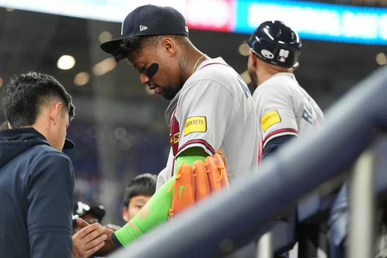 Home 30 Ronald Acuña Jr. posible lesión